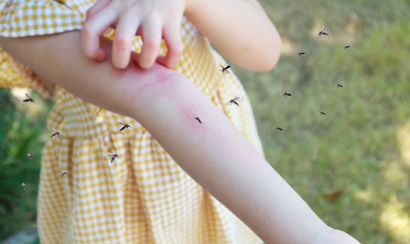 How to Mosquito-Proof Your Outdoor Living Space in San Jose, CA